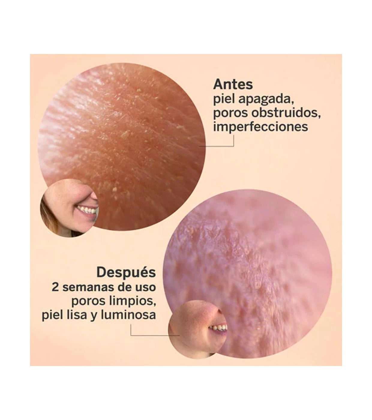 Segle - Sérum Visage Exfoliant Acide Glycolique Glicolmix – Image 3