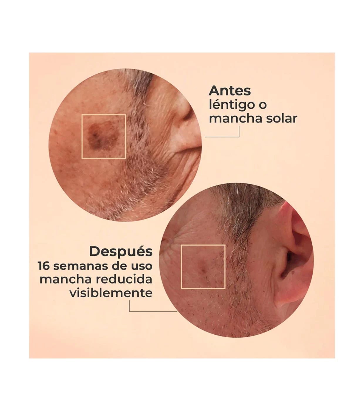 Segle - Sérum Visage Exfoliant Acide Glycolique Glicolmix – Image 6